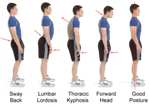 improve your posture